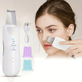 Peeling Ultrassônico Limpador Facial - Renovação e Rejuvenescimento da Pele Sem Dor - Entrega de 4/5 dias